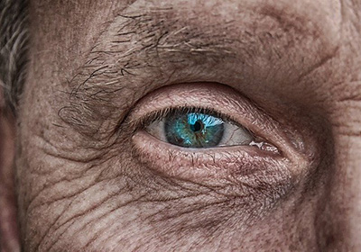 Old loose skin around an eye. Image by analogicus from Pixabay