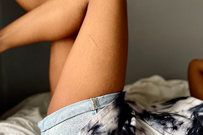 Person in shorts lying on bed with leg up - by Photo by Ayanda M on Pexels