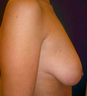 patient_3_before_3