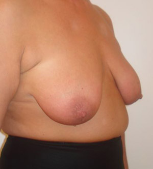patient_5_before_2
